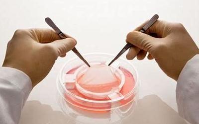 Suggerimenti di lettura: i sostituti cutanei bioingegnerizzati nella guarigione delle ferite