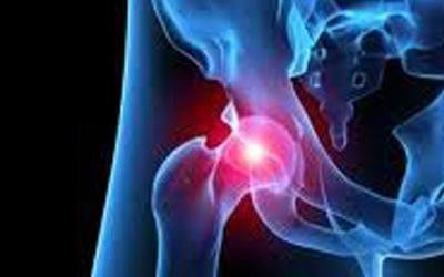 Co-gestione ortogeriatrica per la cura dei soggetti anziani con frattura di femore: raccomandazioni da una consensus intersocietaria italiana